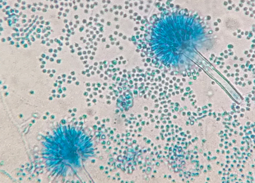 Aspergillus