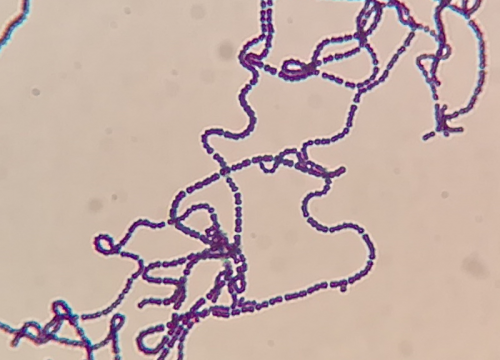 Streptococcus agalactiae