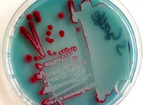Serratia marcescens