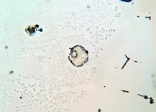 Echinococcus