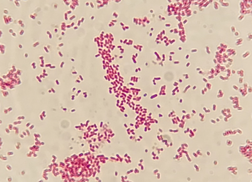Salmonella enterica Enteritidis