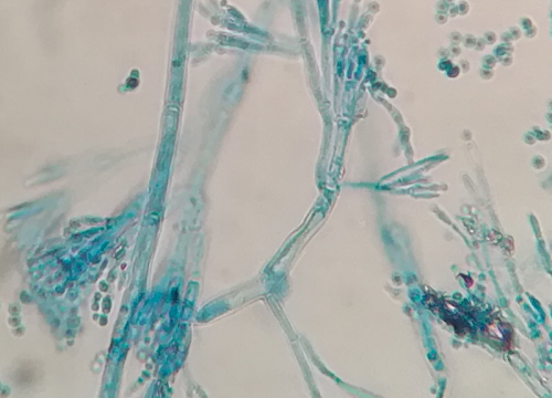 Penicillium