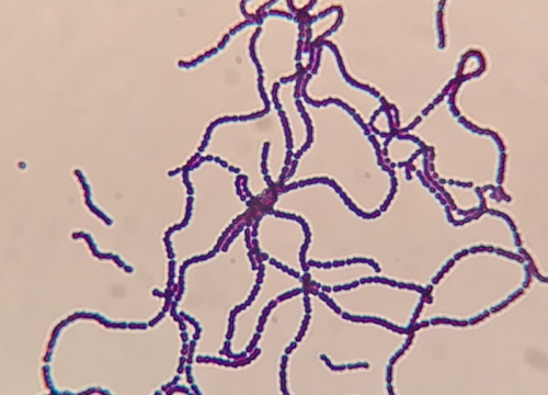 Streptococcus agalactiae