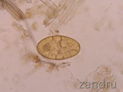 Fasciola hepatica Ei