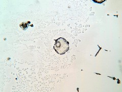 Echinococcus