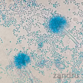 Aspergillus