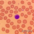 Lymphozyt