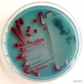 Serratia marcescens