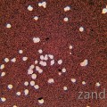 Cryptococcus