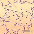 Streptococcus viridans