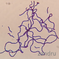 Streptococcus agalactiae