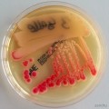 Serratia marcescens